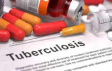 Jangan Panik! Ini Beragam Efek Samping Obat Anti Tuberkulosis (OAT) dan Solusinya