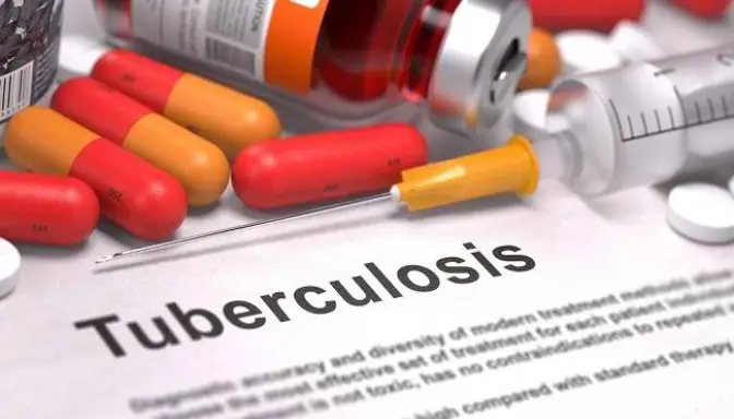 Jangan Panik! Ini Beragam Efek Samping Obat Anti Tuberkulosis (OAT) dan Solusinya