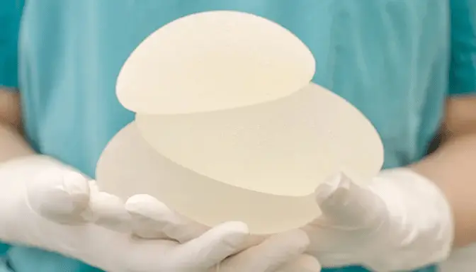 Bahaya Efek Samping Implan Kontrasepsi dan Payudara 2 Bahaya Efek Samping Implan Kontrasepsi dan Payudara