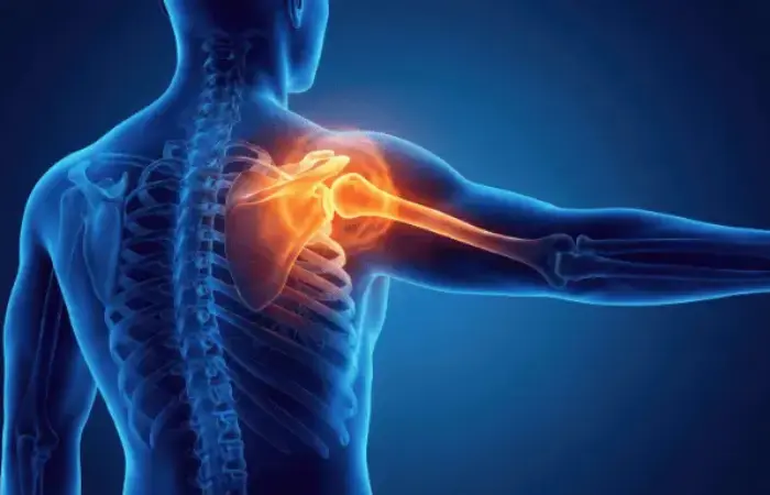 Obat Asam Urat Paling Efektif untuk Redakan Nyeri Sendi