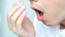 Bau Mulut (Halitosis)