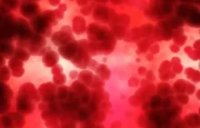 Amiloidosis