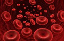 Anemia