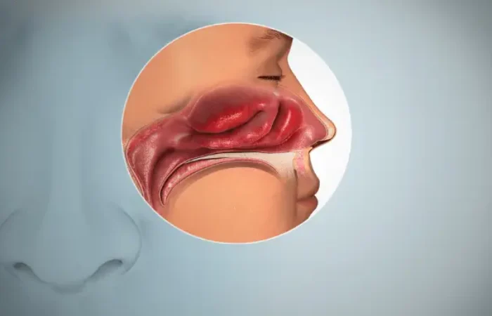 Anosmia adalah Hilangnya Indra Penciuman dan Cara Mengatasinya
