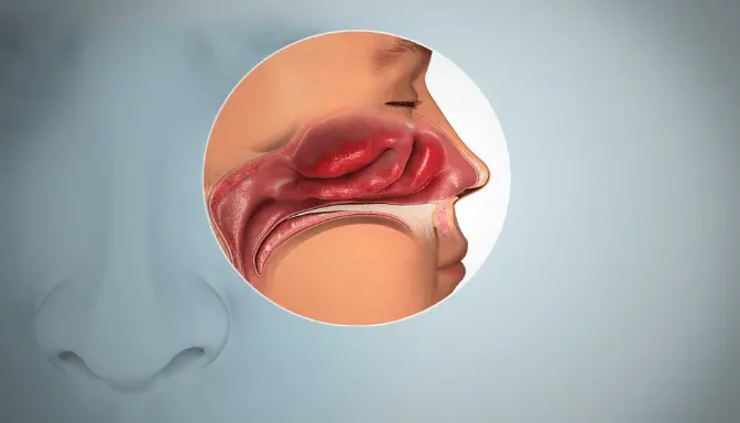 Anosmia 6 Anosmia adalah Hilangnya Indra Penciuman dan Cara Mengatasinya