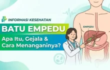 Batu Empedu
