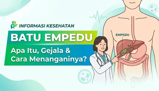 Batu Empedu: Penyebab, Gejala, dan Cara Mengobati