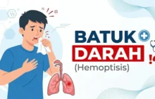 Batuk darah