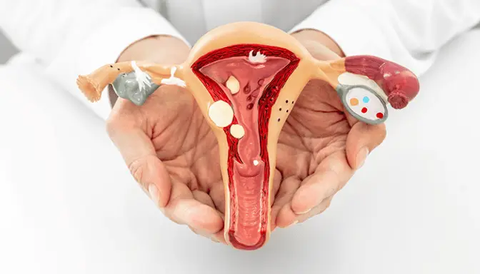 Mengenal Adenomiosis pada Rahim, Tanda dan Pengobatan