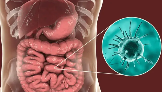 Mengenal Amebiasis, Infeksi Parasit pada Usus