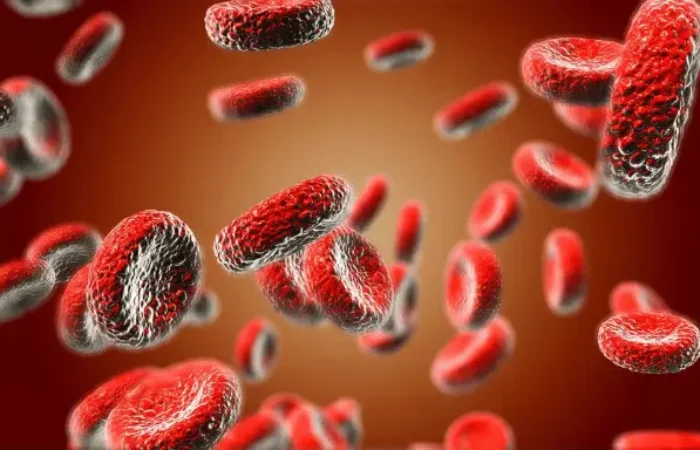 Anemia Defisiensi Besi