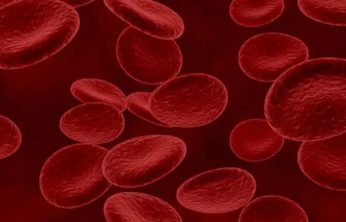 Anemia Hemolitik