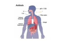Asidosis