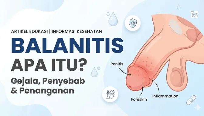 Mengenal Balanitis pada Pria, Penyebab dan Pengobatan