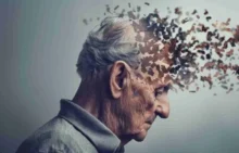 Alzheimer