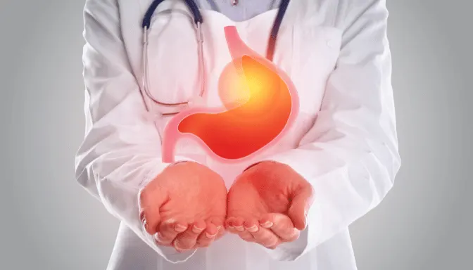 Acilaz 4 Panduan Lengkap Acilaz untuk Asam Lambung dan GERD