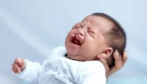 Bibir Sumbing: Penyebab, Operasi, dan Dampaknya pada Tumbuh Kembang Anak